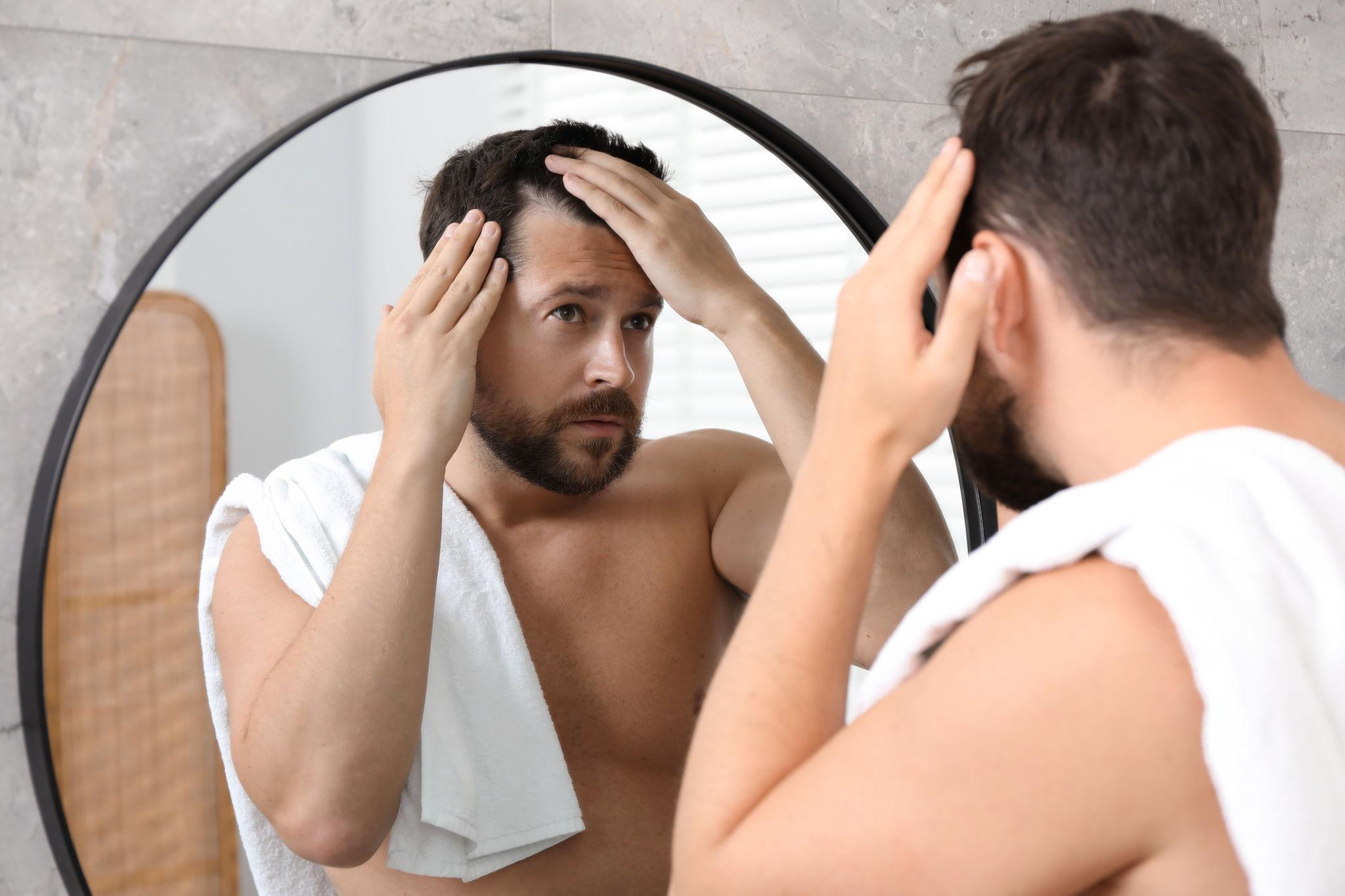 Minoxidil bijwerkingen: wat je moet weten voor je begint