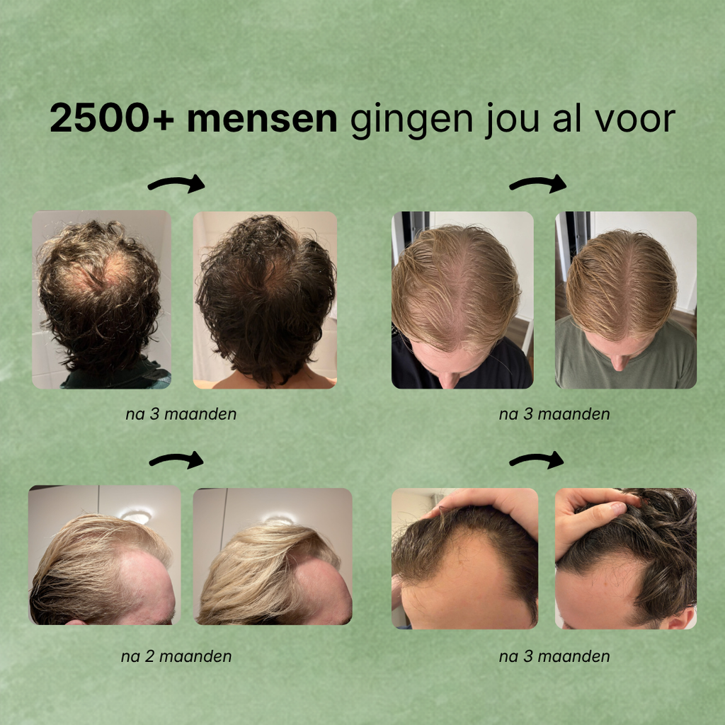 2500+ mensen gingen je voor – resultaten met Hairborn