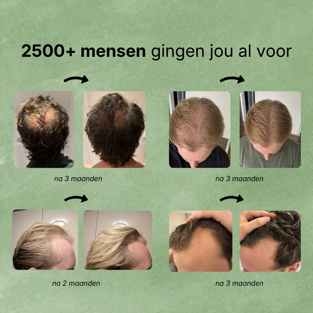 2500+ mensen gingen je voor – resultaten met Hairborn
