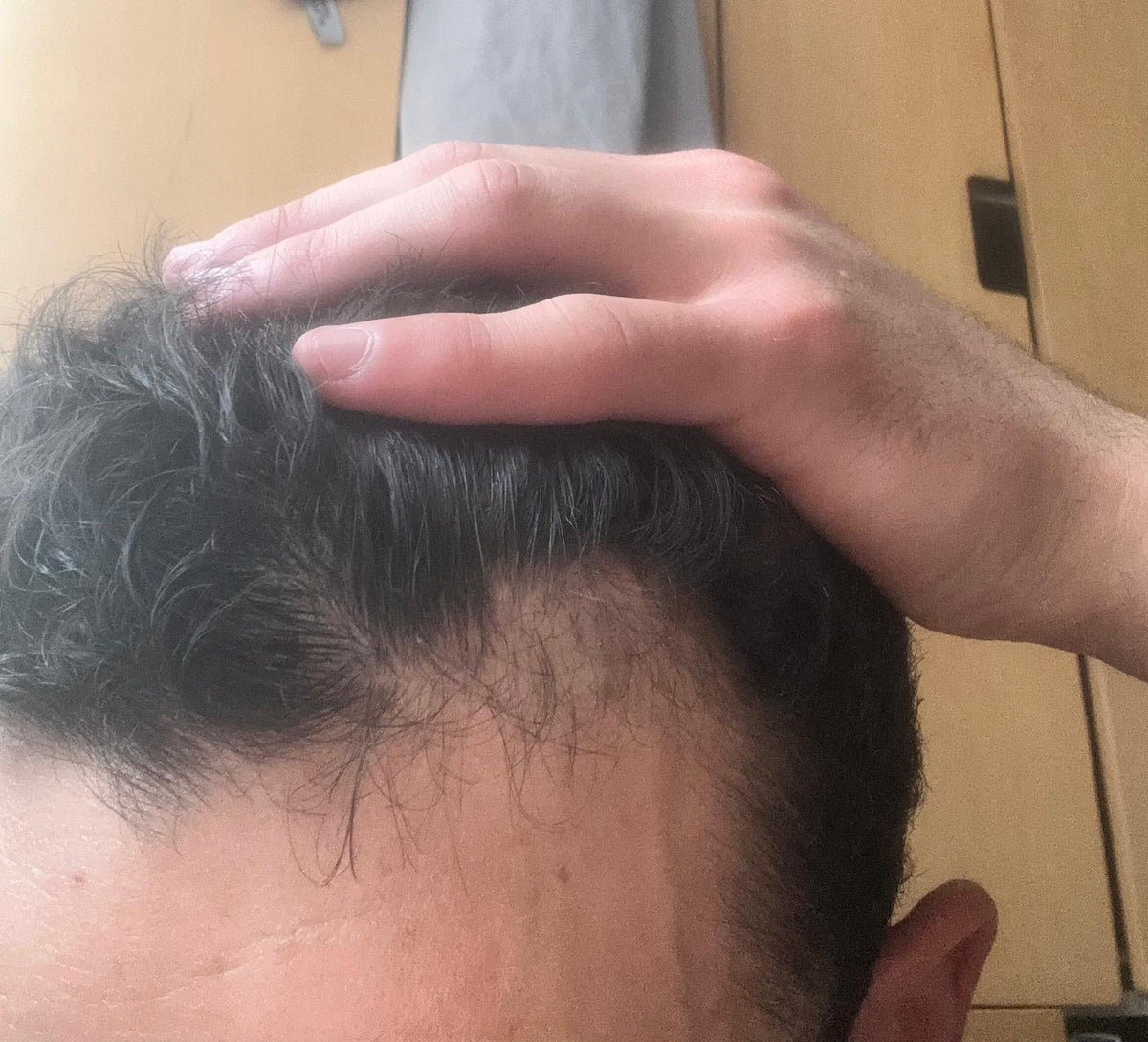 After