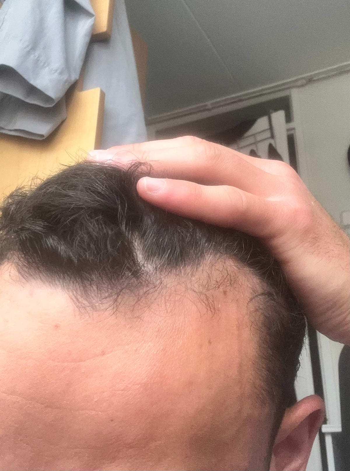 Before