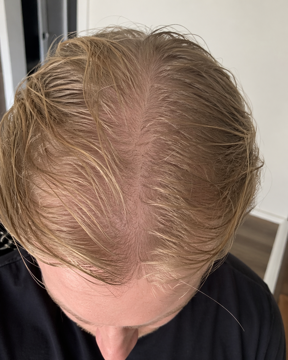 Before