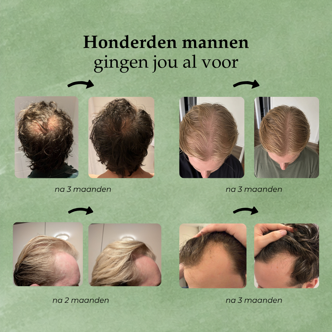 Hairborn® Groei Serum