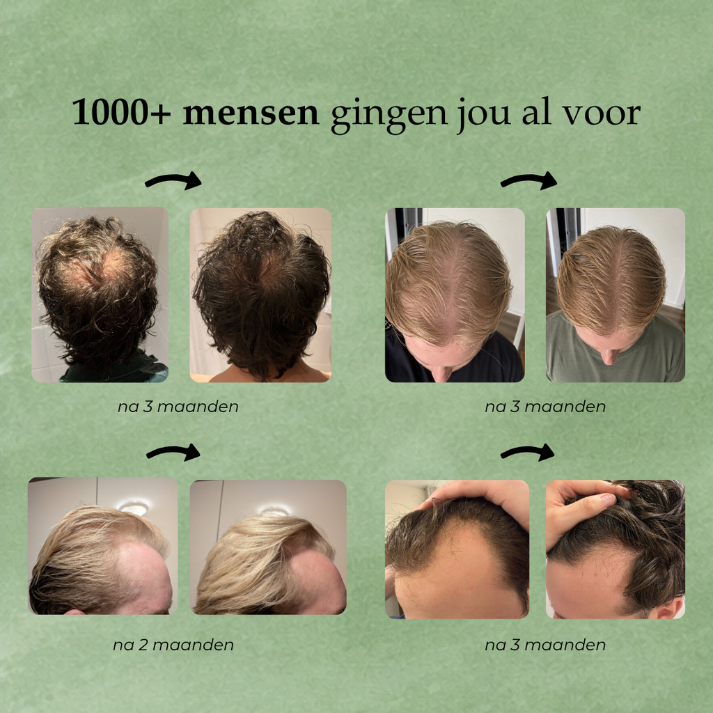 Hairborn® Groei Serum