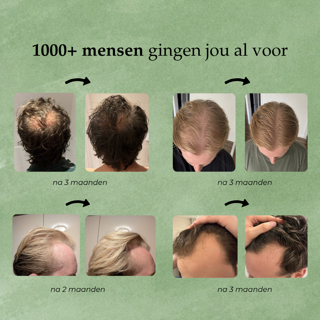 Hairborn® Groei Serum