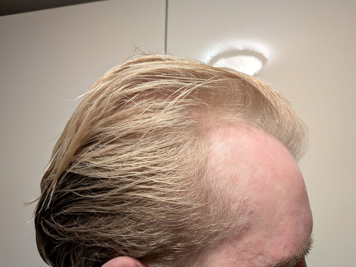Before