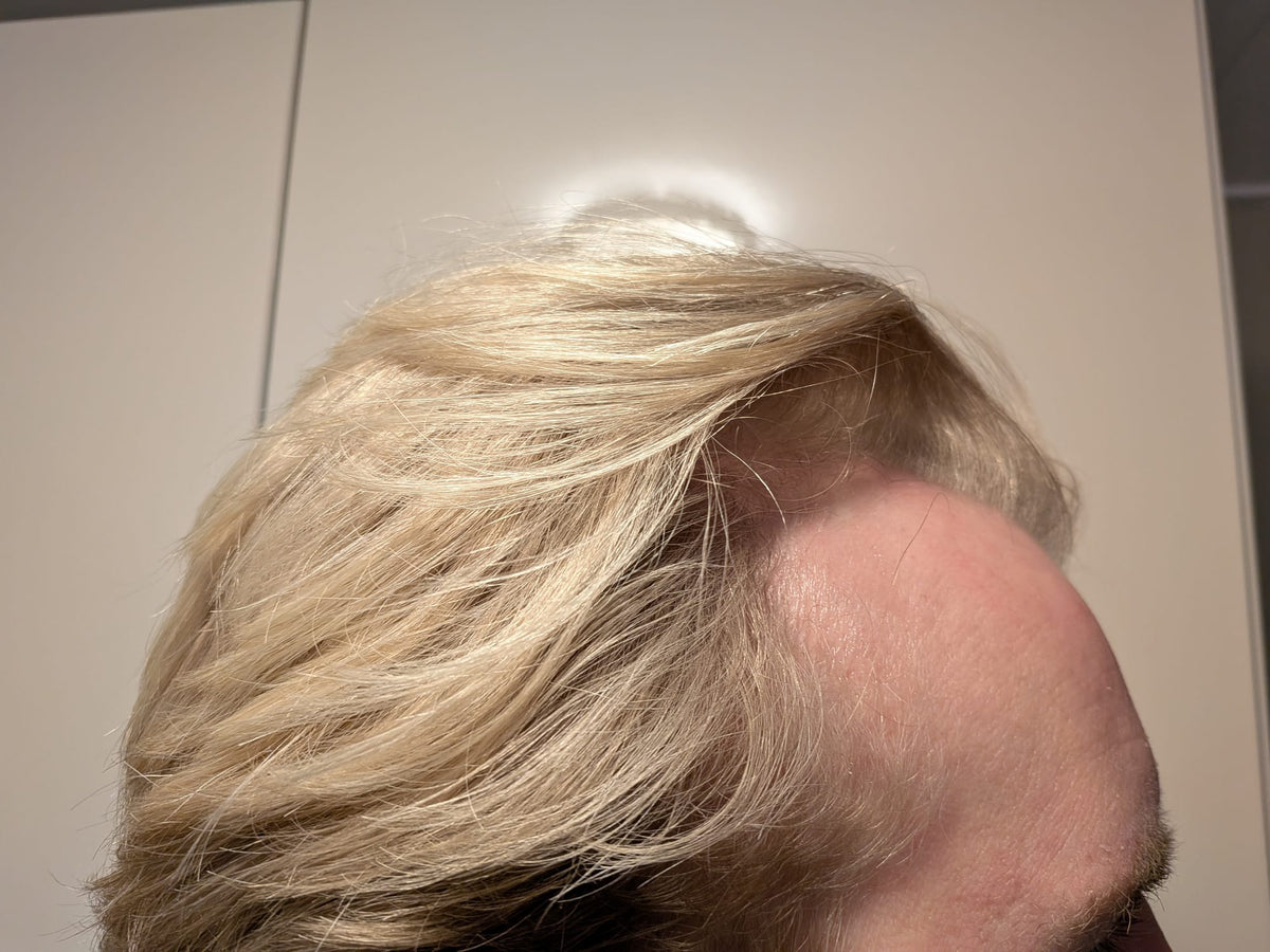After